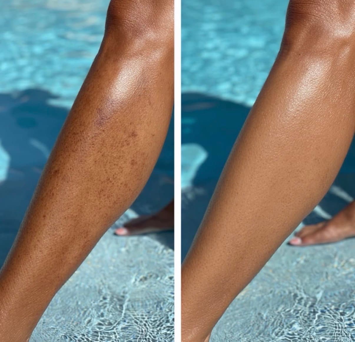 hydrating body gel